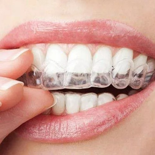 The Latest Advances In Orthodontic Technology: What You Need To Know